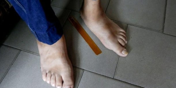 Sorprendente Las Fotos Del Hombre Con Los Pies Más Grandes Del Mundo 